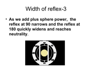 3-Width of reflex
• As we add plus sphere power, the
reflex at 90 narrows and the reflex at
180 quickly widens and reaches
neutrality.
 
