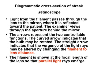 Diagrammatic cross-section of streak
retinoscope.
• Light from the filament passes through the
lens to the mirror, where it is reflected
toward the patient. The examiner views
through the aperture behind the mirror.
• The arrows represent the two controllable
functions. The curved arrow indicates that
the bulb may be rotated. The straight arrow
indicates that the vergence of the light rays
may be altered by changing the filament to
lens distance.
• The filament is shown at the focal length of
the lens so that parallel light rays emerge.
 