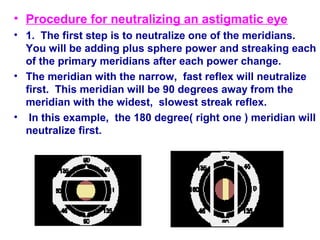 • Procedure for neutralizing an astigmatic eye
• 1. The first step is to neutralize one of the meridians.
You will be adding plus sphere power and streaking each
of the primary meridians after each power change.
• The meridian with the narrow, fast reflex will neutralize
first. This meridian will be 90 degrees away from the
meridian with the widest, slowest streak reflex.
• In this example, the 180 degree( right one ) meridian will
neutralize first.
 