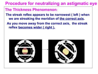 The Thickness Phenomenon:
The streak reflex appears to be narrowest ( left ) when
we are streaking the meridian of the correct axis.
As you move away from the correct axis, the streak
reflex becomes wider ( right ).
Procedure for neutralizing an astigmatic eye
 