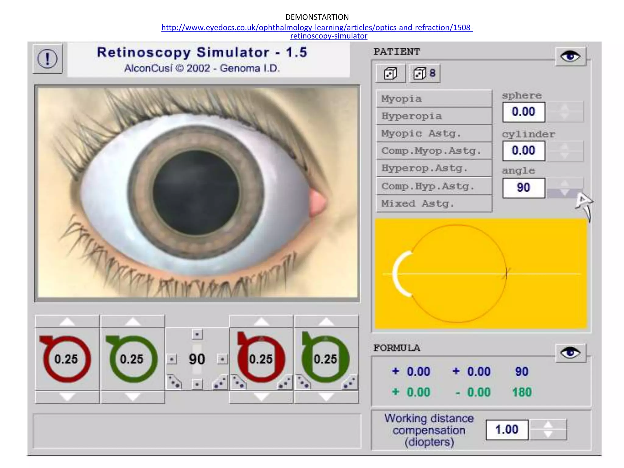Retinal Scanner Simulator Retinoscopy | PPTX