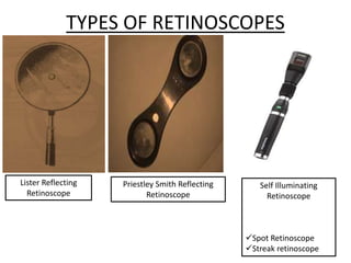 TYPES OF RETINOSCOPES
Lister Reflecting
Retinoscope
Priestley Smith Reflecting
Retinoscope
Self Illuminating
Retinoscope
Spot Retinoscope
Streak retinoscope
 