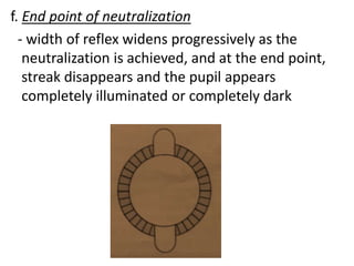 f. End point of neutralization
- width of reflex widens progressively as the
neutralization is achieved, and at the end point,
streak disappears and the pupil appears
completely illuminated or completely dark
 
