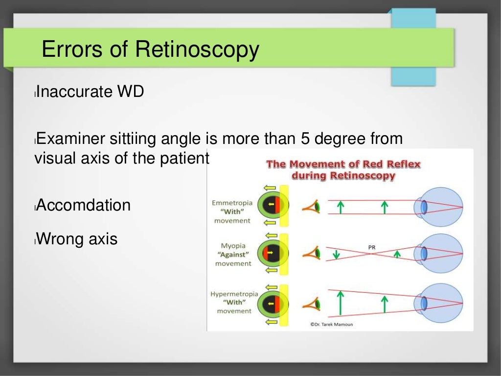 Retinoscopy by Pratyush