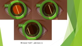 RR moves “with” , add more (+)
 