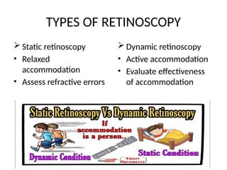 Dynamic Retionoscopy Retinoscopy -Accurate and Objective measurement of the refractive state ...