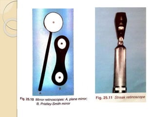 Retinoscopy Ruler Retinoscopy dr-171026143930 copy | PDF
