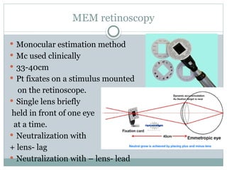 Mem Dynamic Retinoscopy RETINOSCOPY- key principles and techniques | PPTX