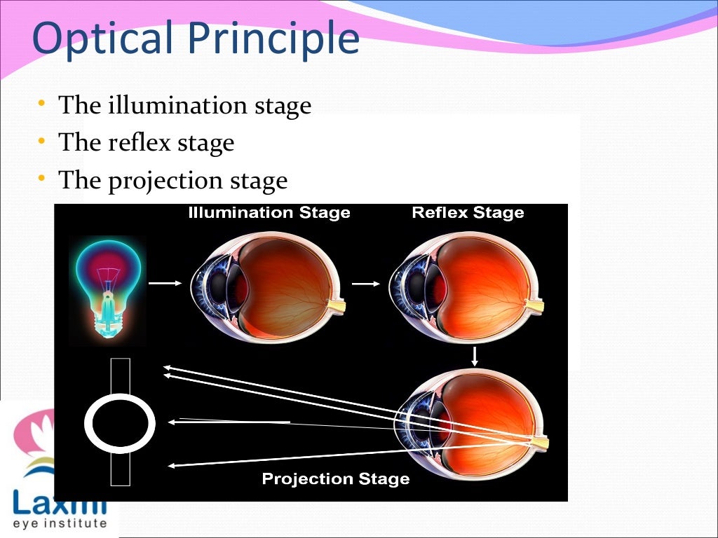 Retinoscopy and its principles
