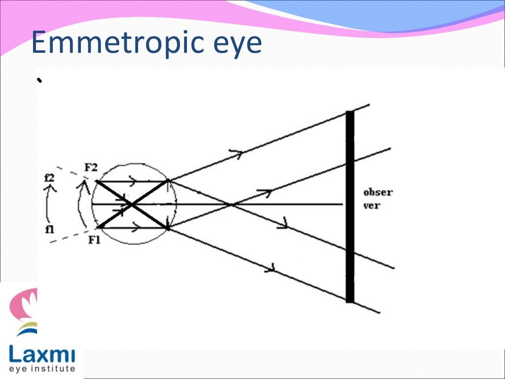Retinoscopy and its principles