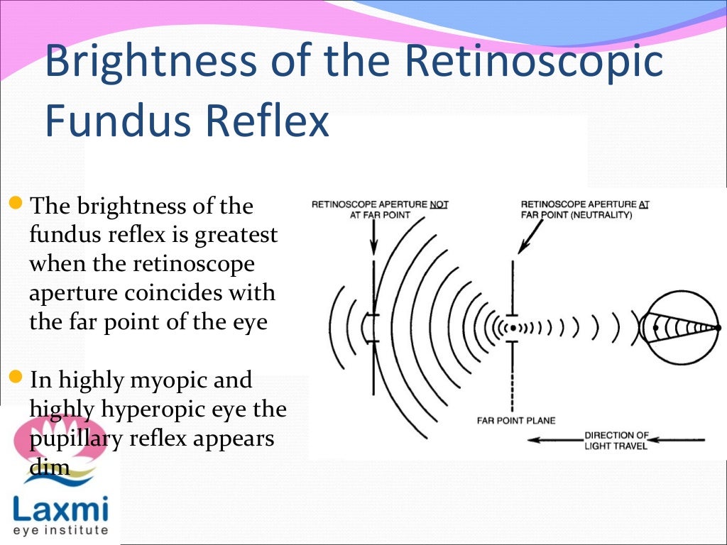 Retinoscopy and its principles