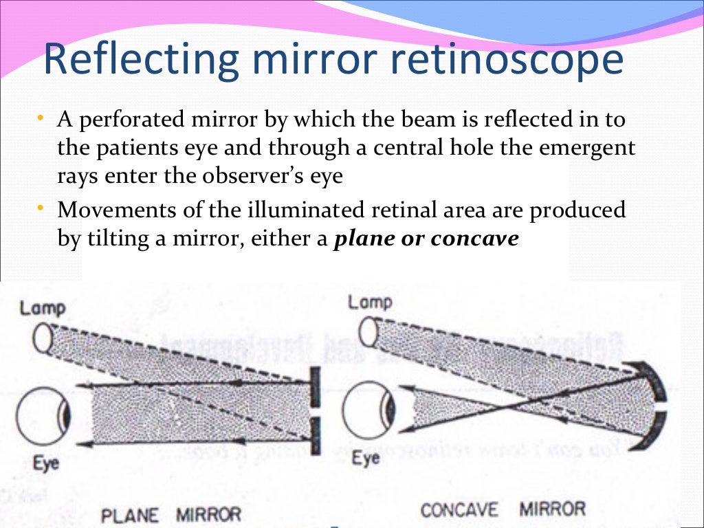 Retinoscopy and its principles