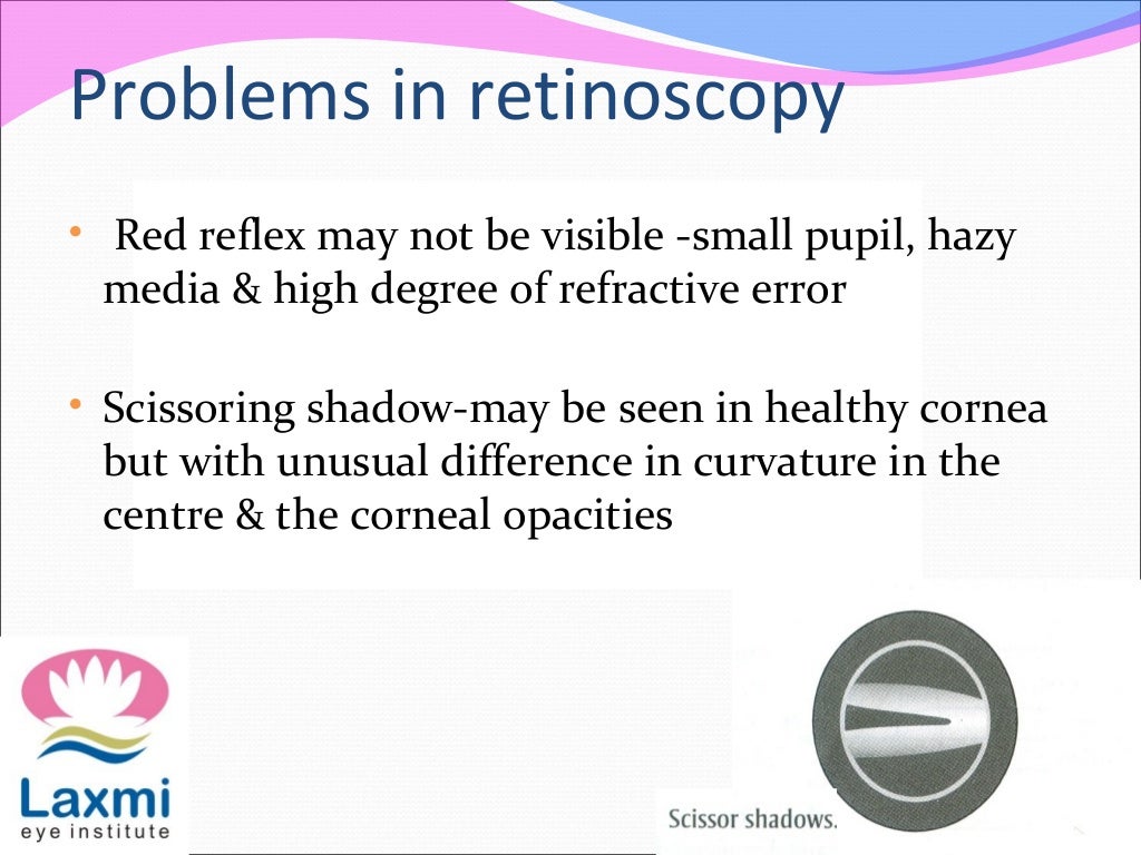 Retinoscopy and its principles