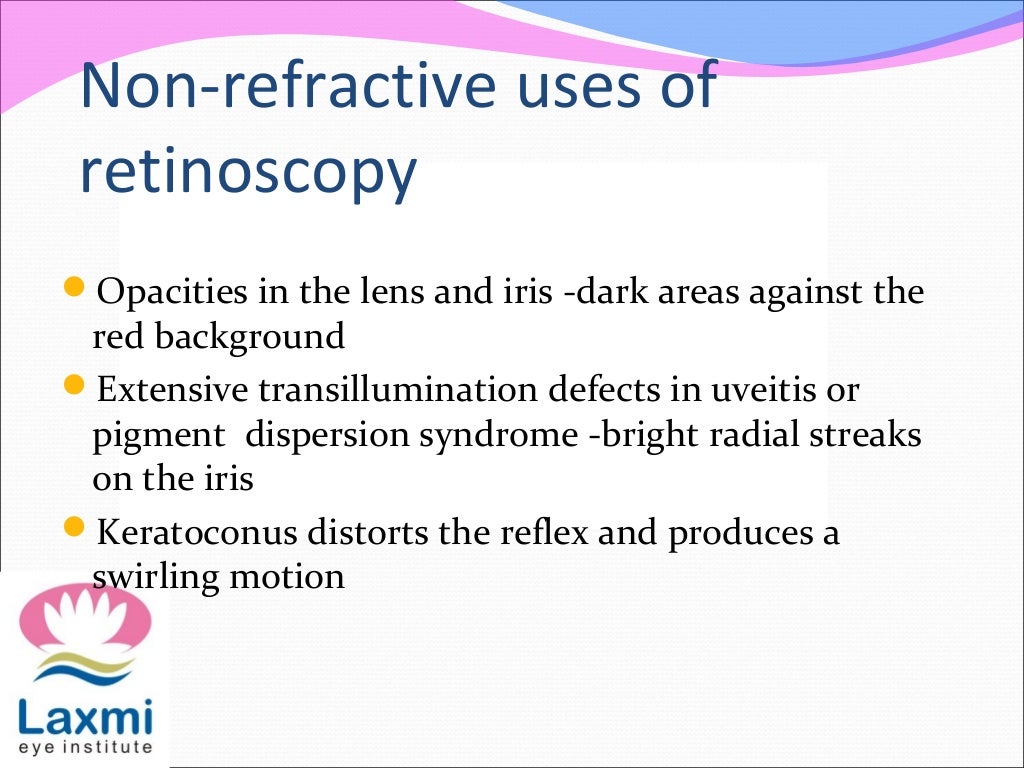Retinoscopy and its principles