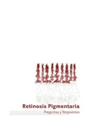 Retinosis Pigmentaria
Preguntas y Respuestas

 