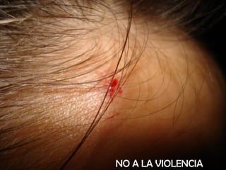 NO A LA VIOLENCIA 