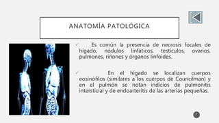 ANATOMÍA PATOLÓGICA
 Es común la presencia de necrosis focales de
hígado, nódulos linfáticos, testículos, ovarios,
pulmones, riñones y órganos linfoides.
 En el hígado se localizan cuerpos
eosinófilos (similares a los cuerpos de Councilman) y
en el pulmón se notan indicios de pulmonitis
intersticial y de endoarteritis de las arterias pequeñas.
7
 