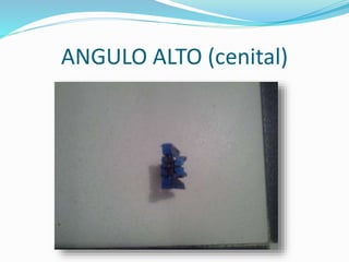 ANGULO ALTO (cenital)
 