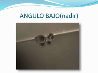 ANGULO BAJO(nadir)
 