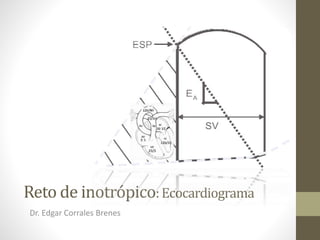 Reto de inotrópico:Ecocardiograma
Dr. Edgar Corrales Brenes
 