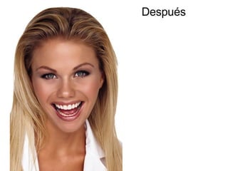 Después