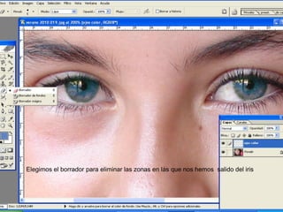Elegimos el borrador para eliminar las zonas en las que nos hemos salido del iris
 