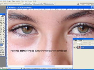Hacemos zoom sobre los ojos para trabajar con comodidad
 