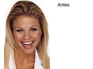 Antes