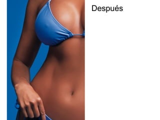 Después