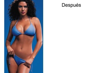 Después
 