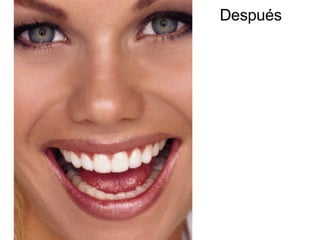 Después