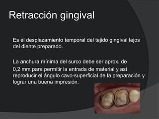 Retracción gingival
Es el desplazamiento temporal del tejido gingival lejos
del diente preparado.

La anchura mínima del s...