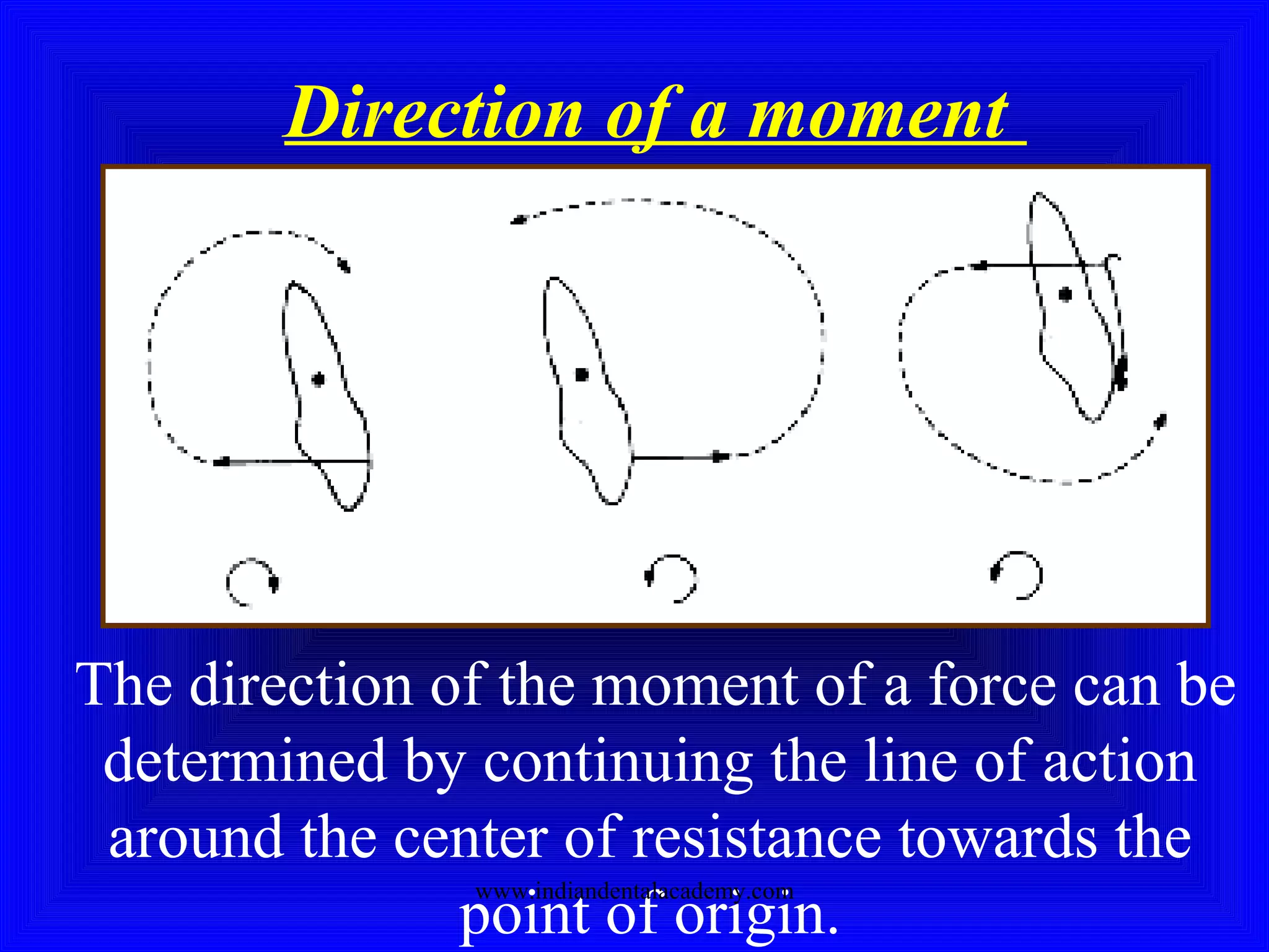 Direction of a moment
The direction of the moment of a force can be
determined by continuing the line of action
around the center of resistance towards the
point of origin.
www.indiandentalacademy.com
 