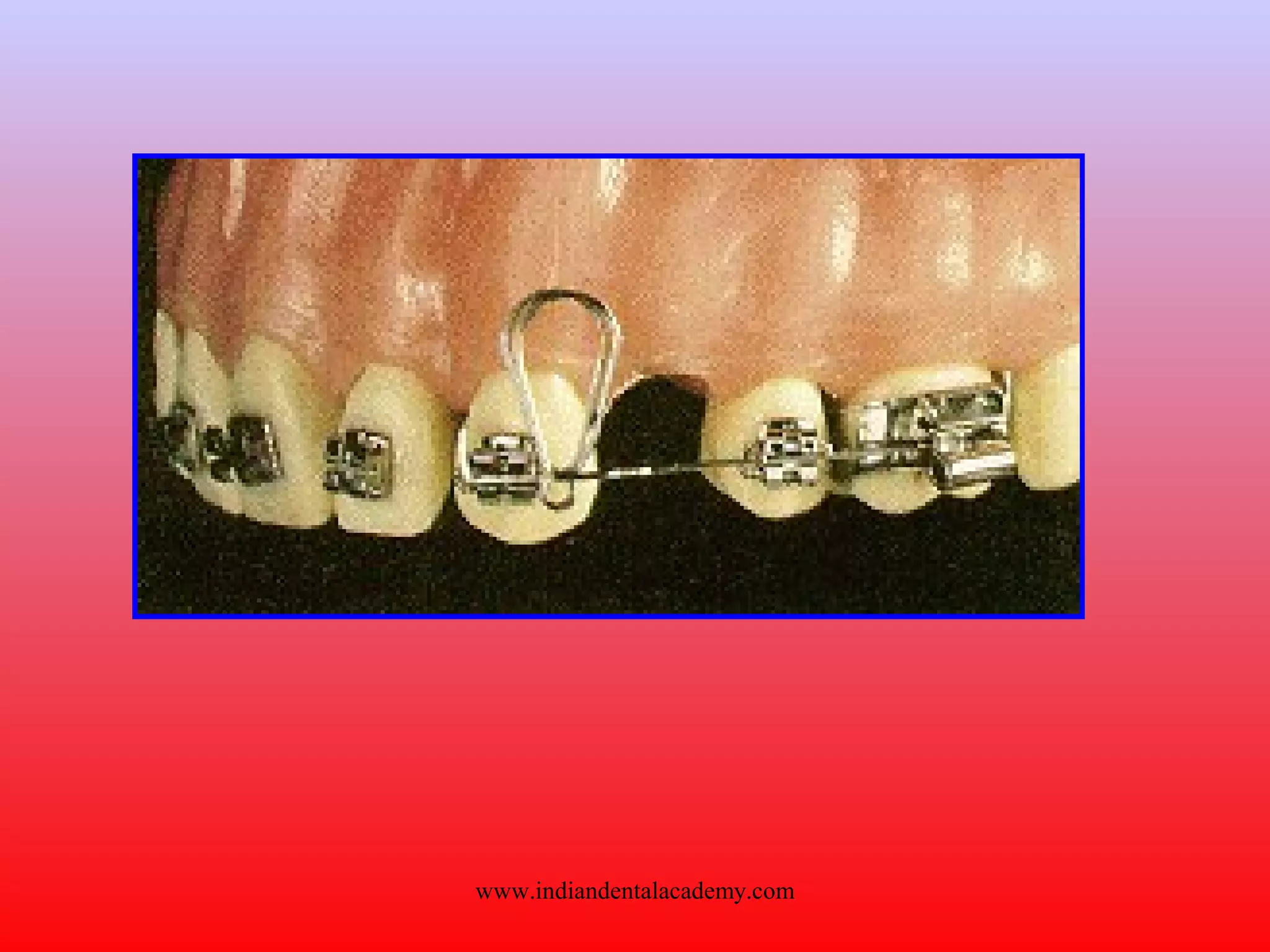 www.indiandentalacademy.com
 