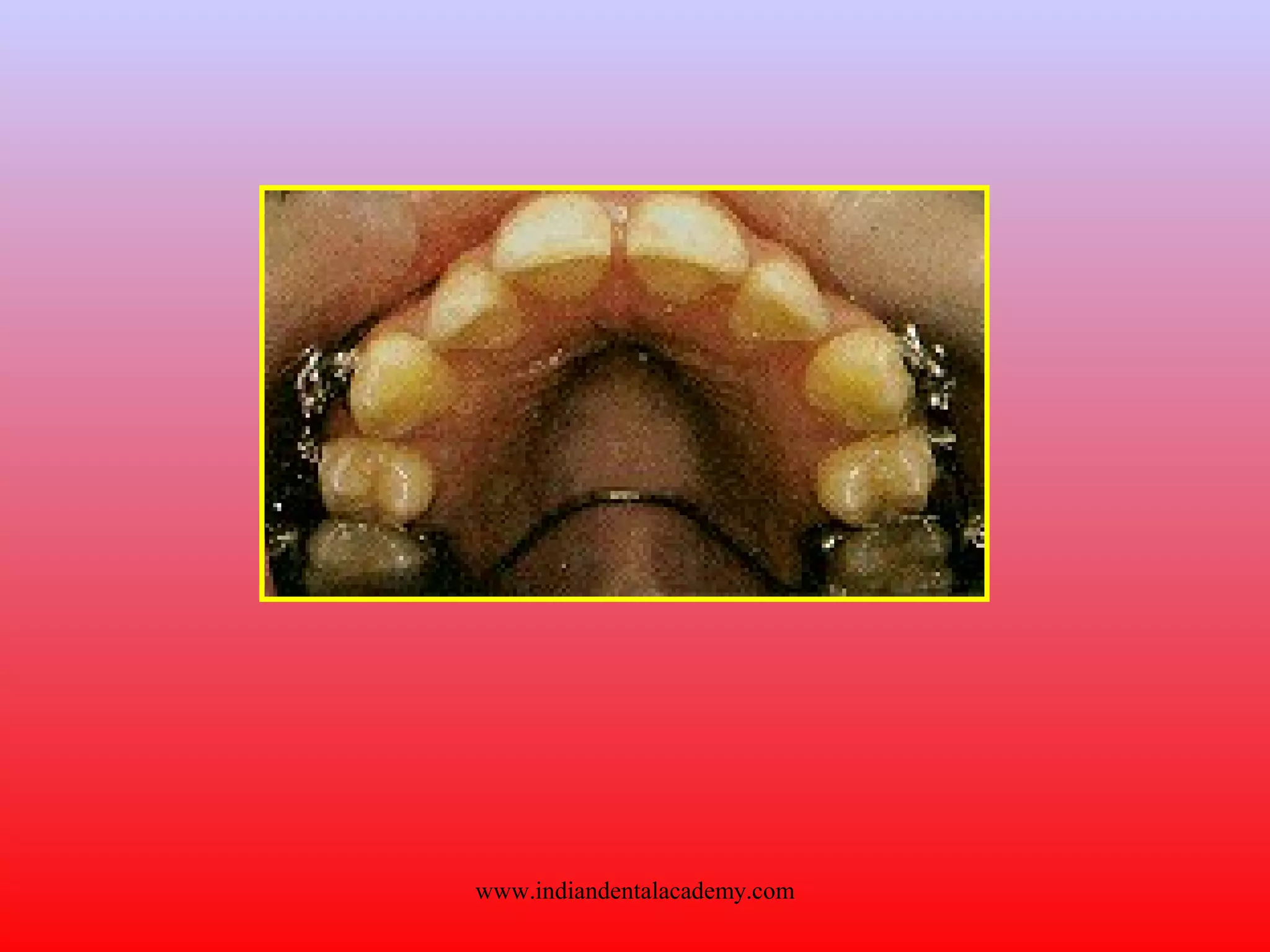 www.indiandentalacademy.com
 
