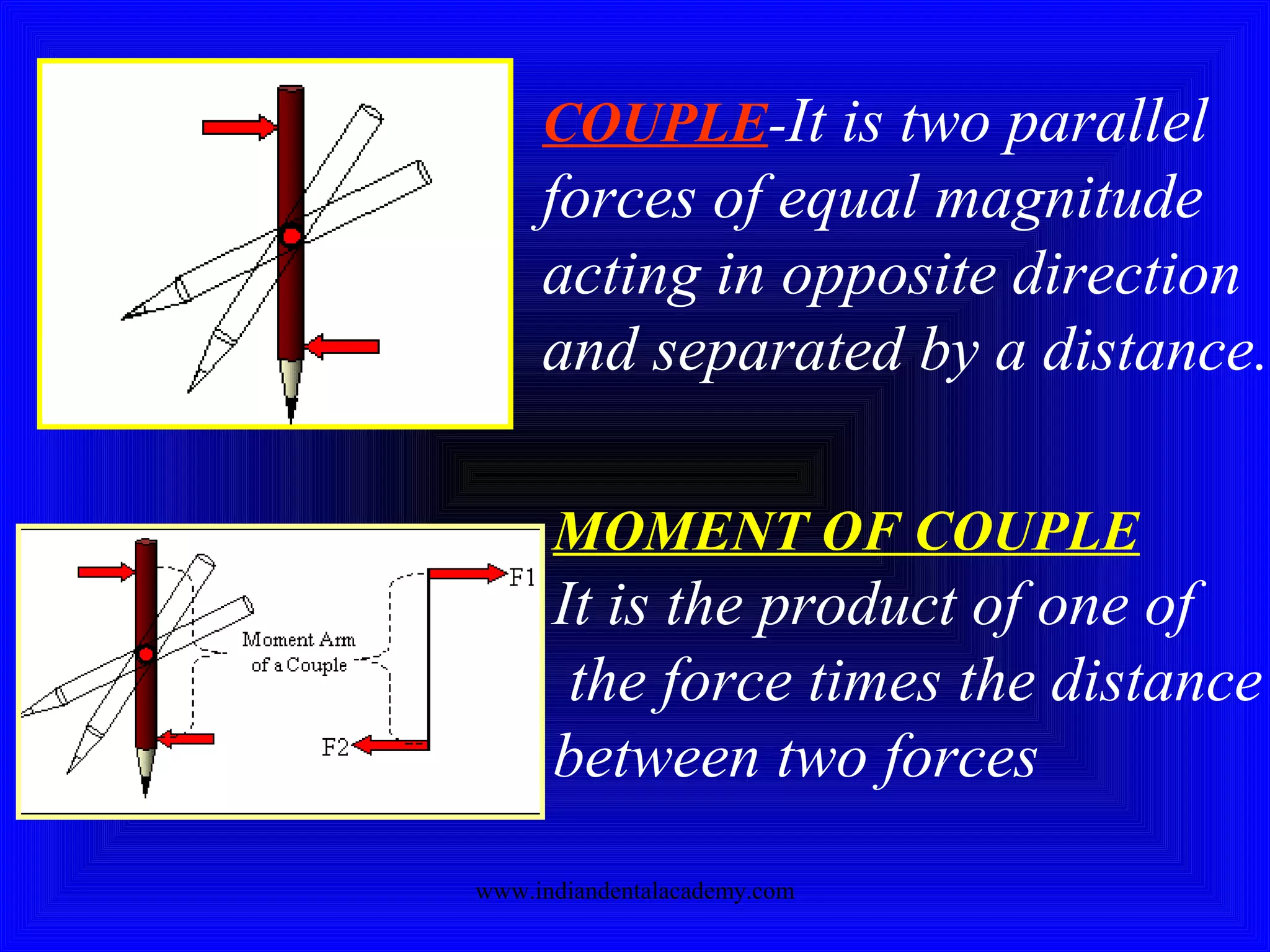 COUPLE-It is two parallel
forces of equal magnitude
acting in opposite direction
and separated by a distance.
MOMENT OF COUPLE
It is the product of one of
the force times the distance
between two forces
www.indiandentalacademy.com
 