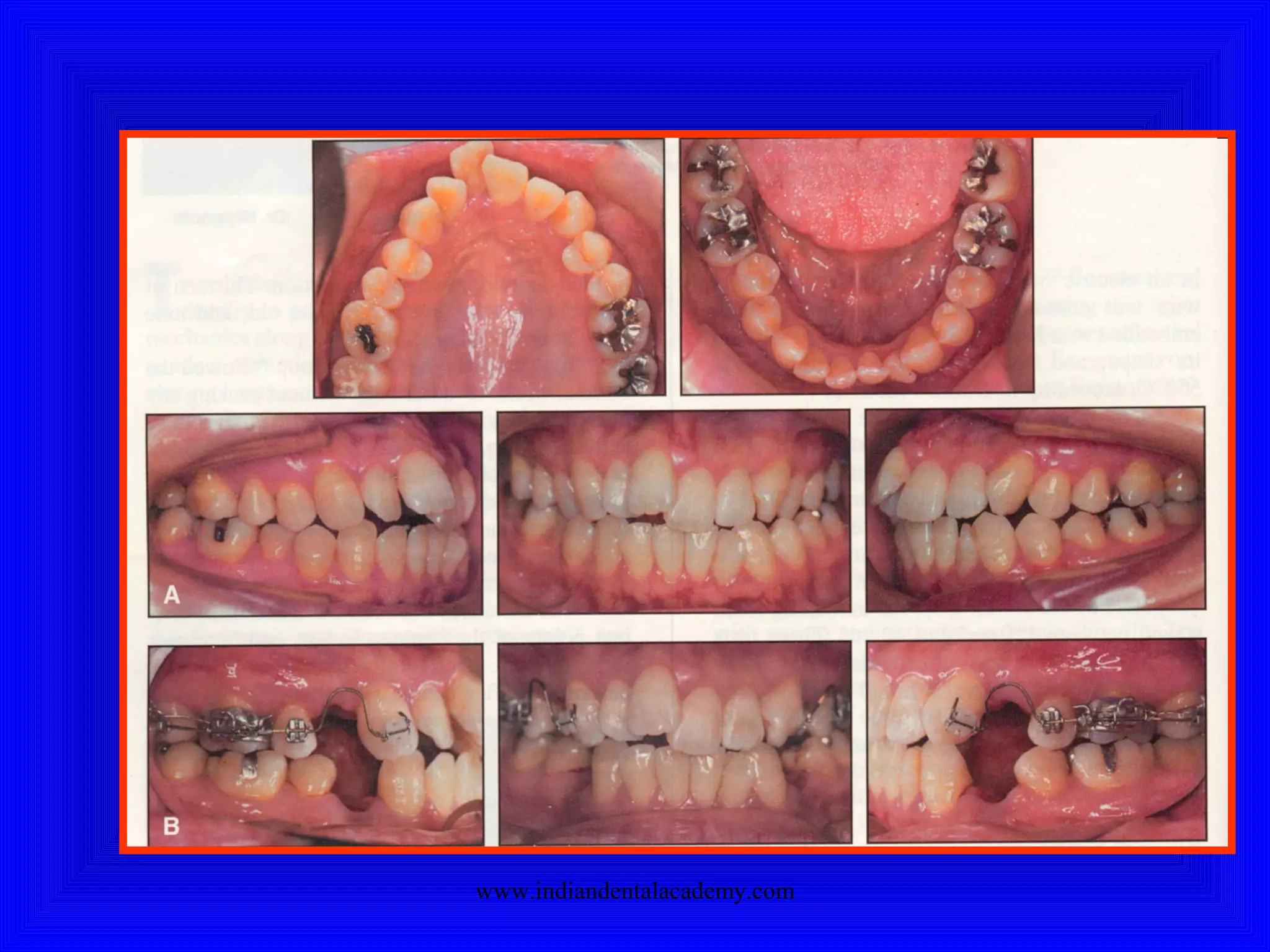 www.indiandentalacademy.com
 