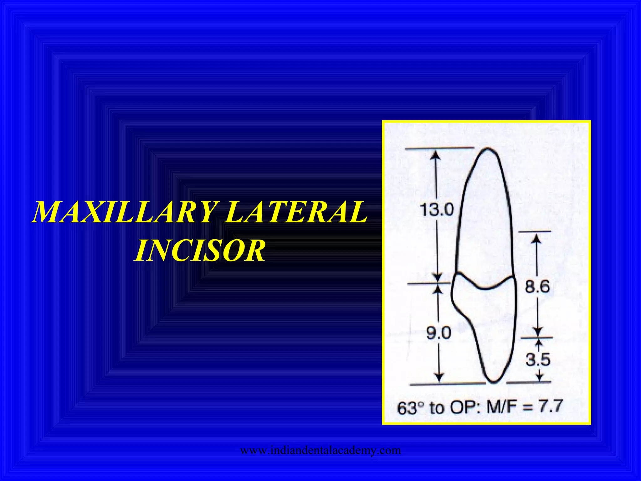 MAXILLARY LATERAL
INCISOR
www.indiandentalacademy.com
 