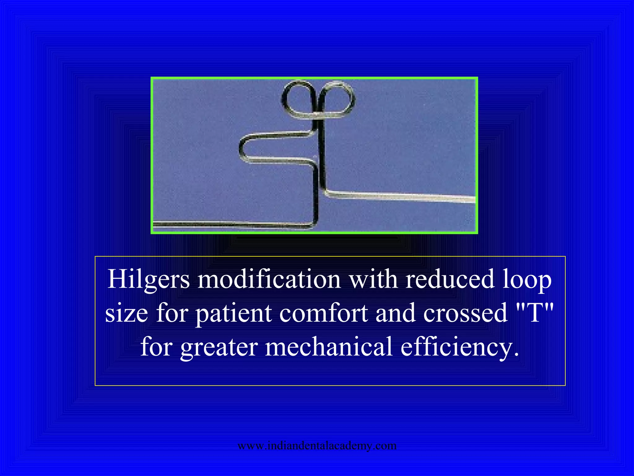 Hilgers modification with reduced loop
size for patient comfort and crossed "T"
for greater mechanical efficiency.
www.indiandentalacademy.com
 