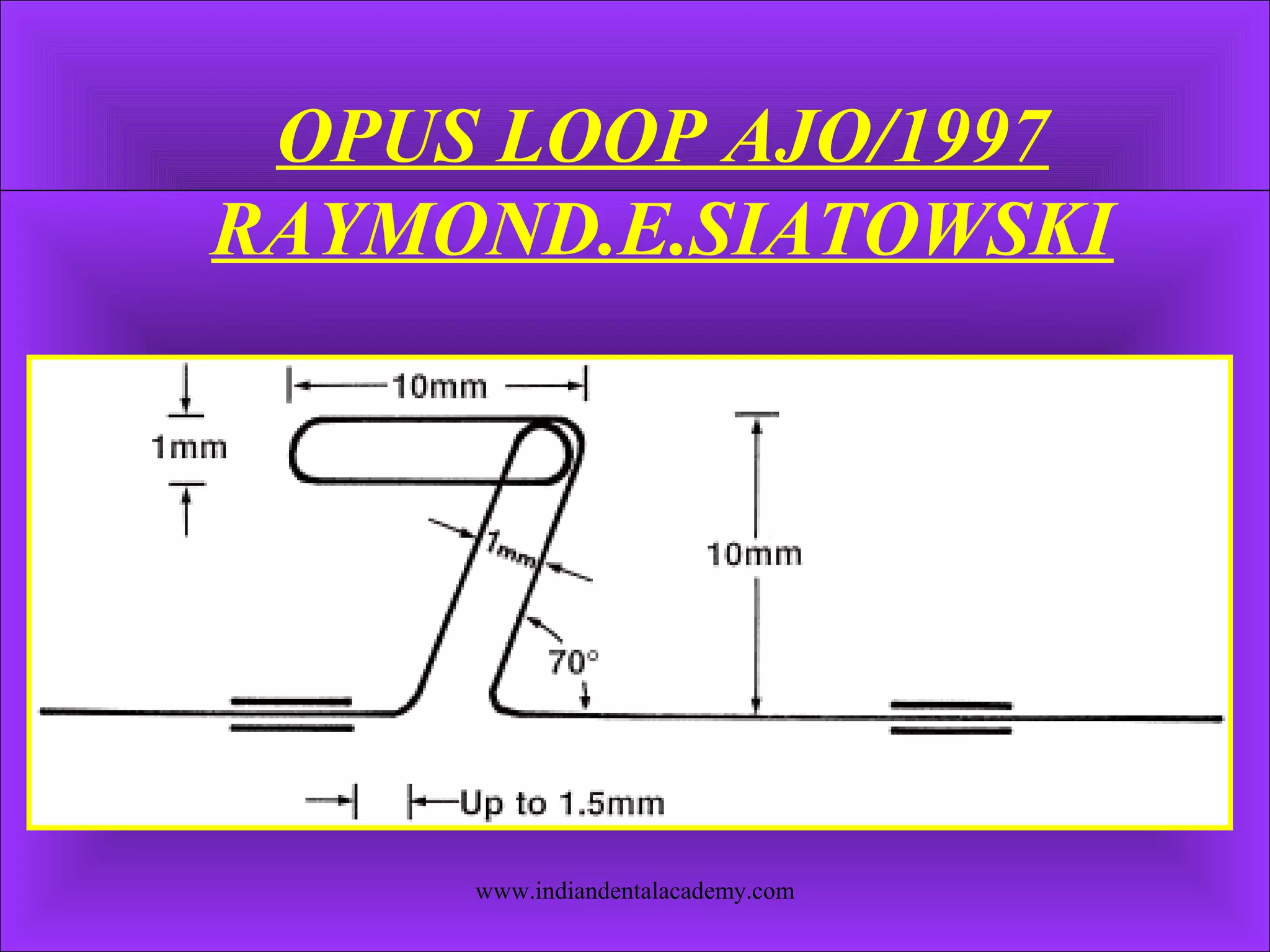 OPUS LOOP AJO/1997
RAYMOND.E.SIATOWSKI
www.indiandentalacademy.com
 