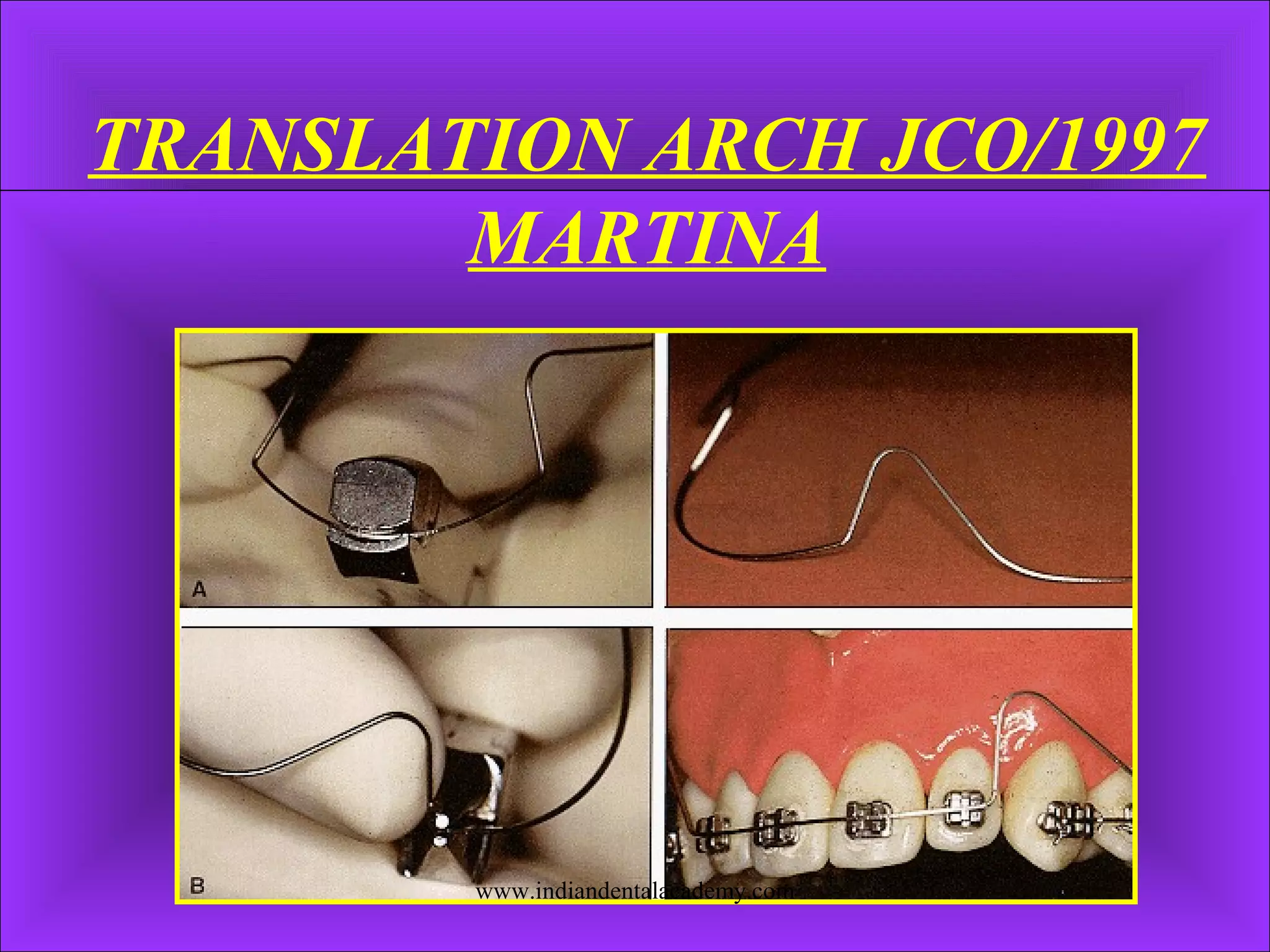 TRANSLATION ARCH JCO/1997
MARTINA
www.indiandentalacademy.com
 