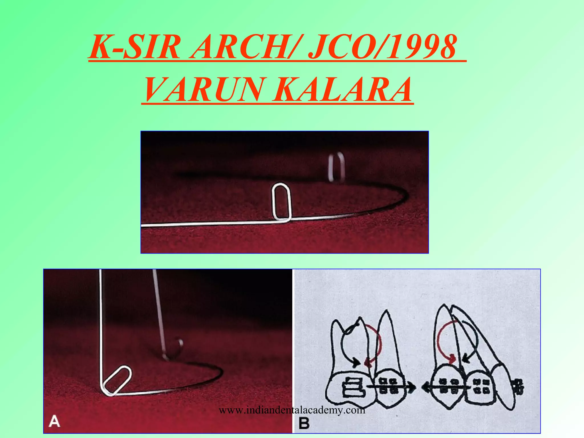 K-SIR ARCH/ JCO/1998
VARUN KALARA
www.indiandentalacademy.com
 