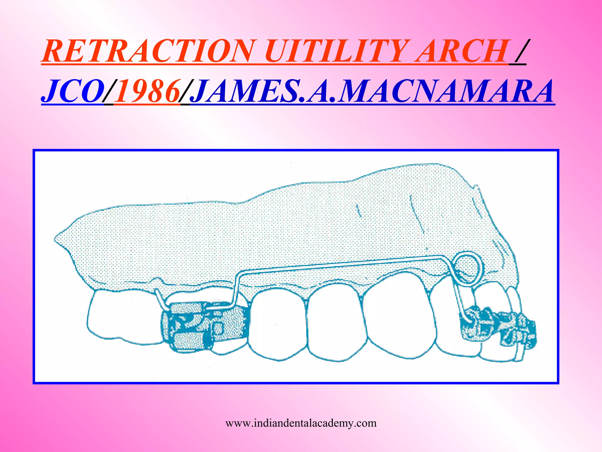 RETRACTION UITILITY ARCH /
JCO/1986/JAMES.A.MACNAMARA
www.indiandentalacademy.com
 