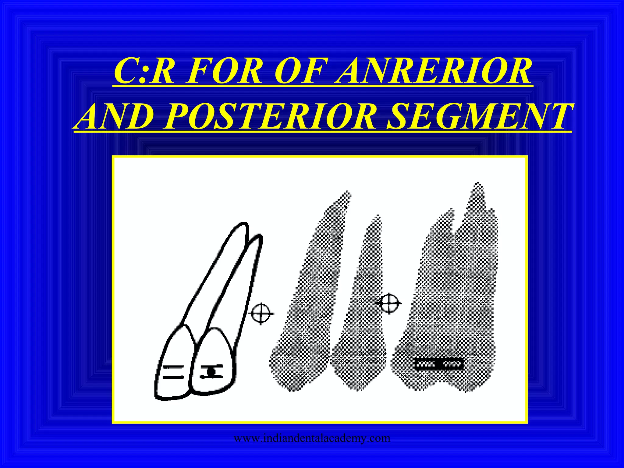 C:R FOR OF ANRERIOR
AND POSTERIOR SEGMENT
www.indiandentalacademy.com
 