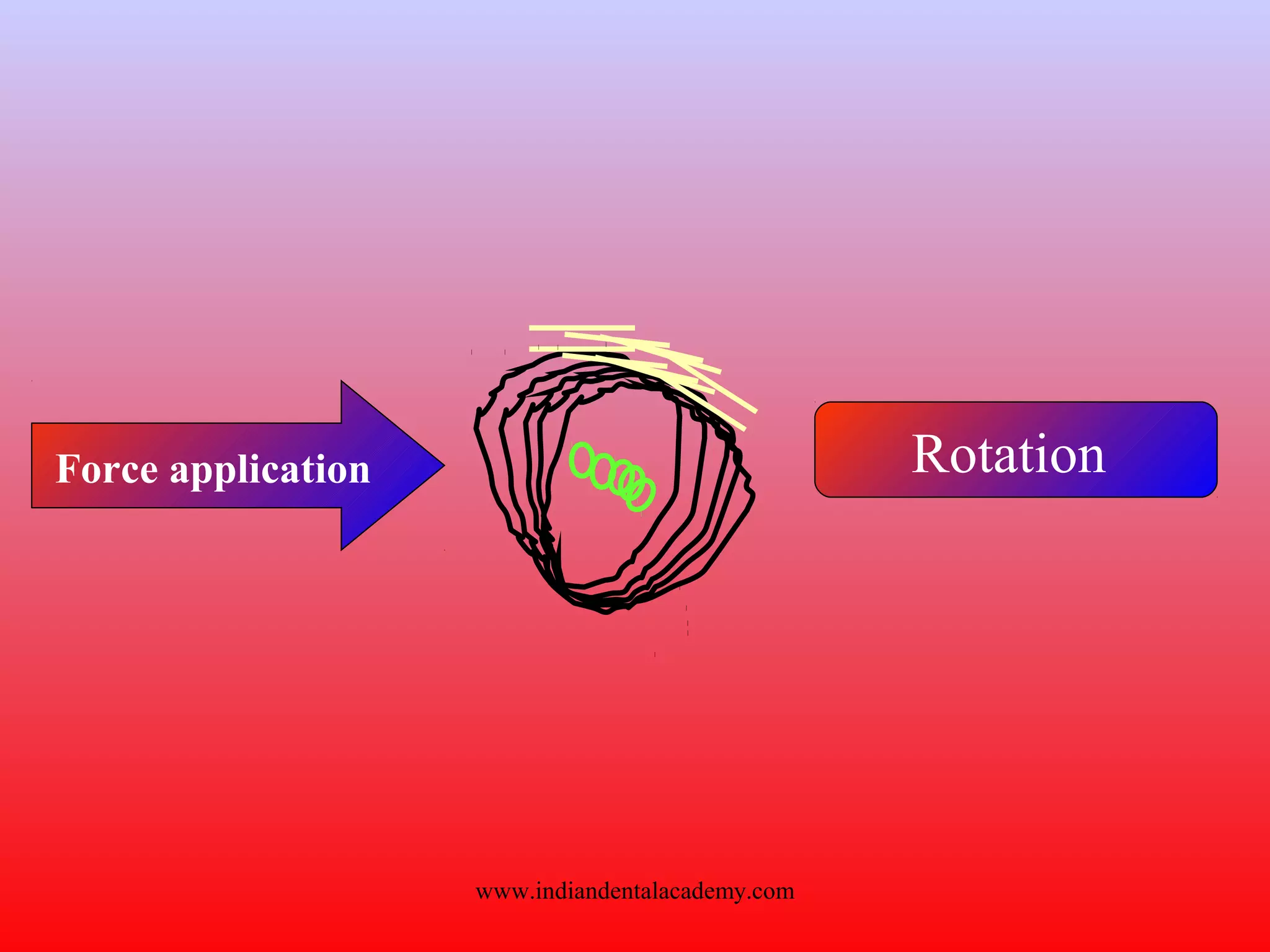 Force application Rotation
www.indiandentalacademy.com
 