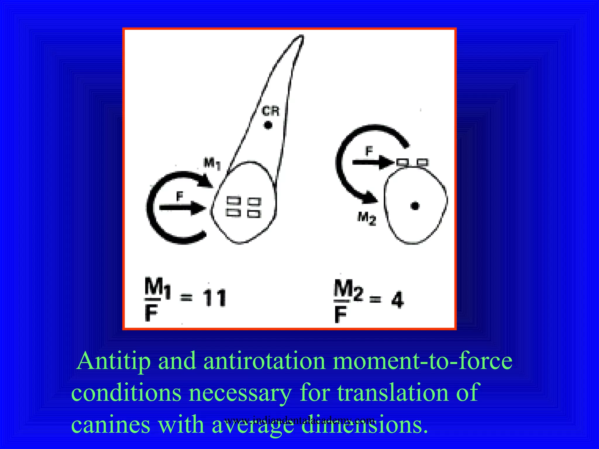 Antitip and antirotation moment-to-force
conditions necessary for translation of
canines with average dimensions.www.indiandentalacademy.com
 