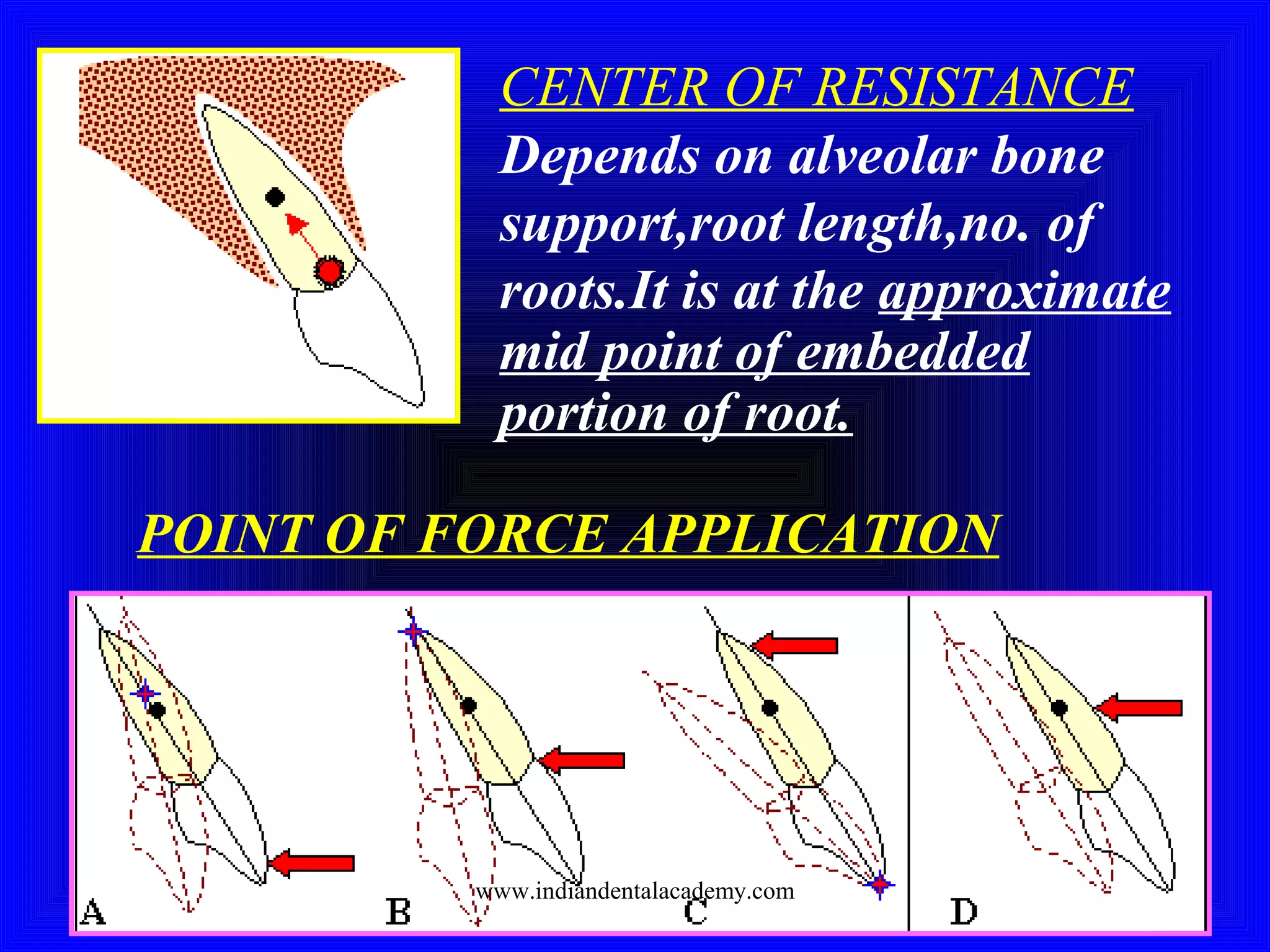 CENTER OF RESISTANCE
Depends on alveolar bone
support,root length,no. of
roots.It is at the approximate
mid point of embedded
portion of root.
POINT OF FORCE APPLICATION
www.indiandentalacademy.com
 