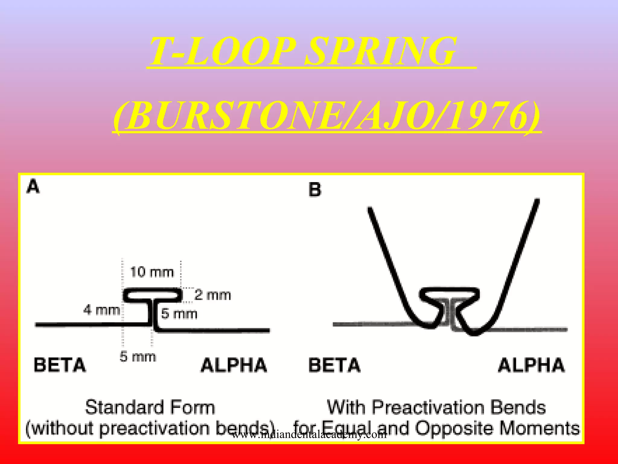 T-LOOP SPRING
(BURSTONE/AJO/1976)
www.indiandentalacademy.com
 