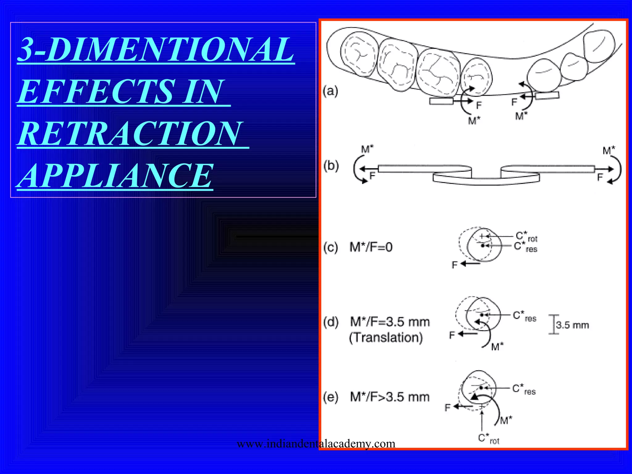 3-DIMENTIONAL
EFFECTS IN
RETRACTION
APPLIANCE
www.indiandentalacademy.com
 