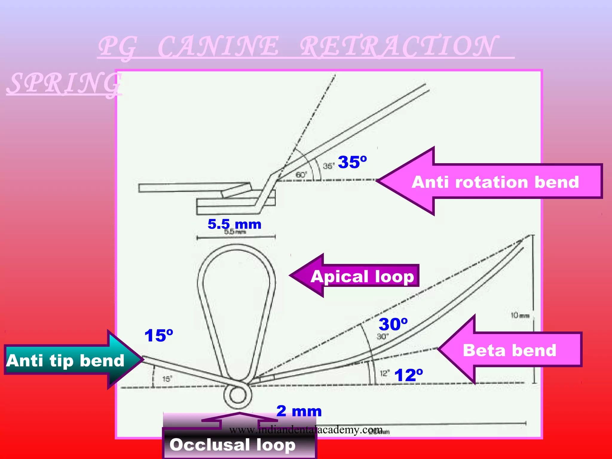 PG CANINE RETRACTION
SPRING
Anti rotation bend
Beta bend
Occlusal loop
Anti tip bend
Apical loop
35º
5.5 mm
15º
2 mm
30º
12º
www.indiandentalacademy.com
 